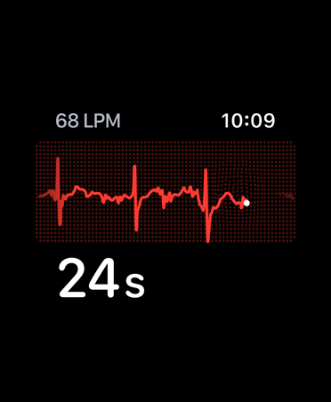 ECG app, beats per minute in top right corner, rhythm line, timer
