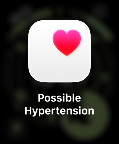 Apple Watch Ultra 3, titanium case, natural color, possible hypertension notification, pink heart in white box, band, Trail Loop, blue/bright blue color