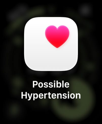 Apple Watch Ultra 3, titanium case, natural color, possible hypertension notification, pink heart in white box, band, Trail Loop, blue/bright blue color