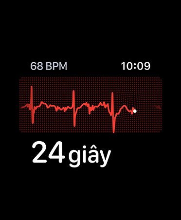 ECG app, beats per minute in top left corner, rhythm line, timer